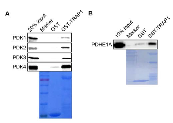 In vitro pulldown assay. (A) TRAP1과 PDK의 결합. (B) TRAP1과 PDH의 결합