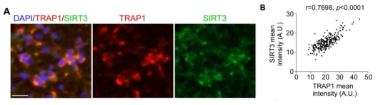 TRAP1과 SIRT3의 co-expression. (A) GBM 환자조직에서 TRAP1과 SIRT3의 immunofluorescence 분석 (B) 두 단백질의 co-expression분석
