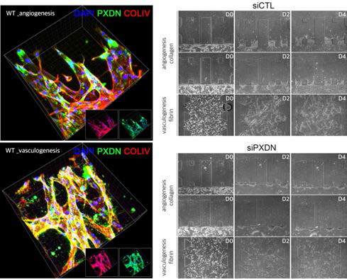 HUVEC의 3D angiogenesis와 vasculogenesis 모델에서 PXDN과 collagen IV의 발현(좌)과 PXDN의 siRNA를 처리한 세포에서 3D angiogenesis와 vasculogenesis 감소(우)