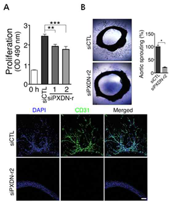 mouse cell에서 mouse/rat PXDN 표적 siRNA의 knockdown 후 세포 증식과 rat aortic ring assay에서 PXDN knockdown 후 angiogenesis