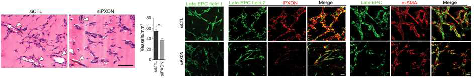 PXDN knockdown 된 GFP-EPC 과 pericyte-like cell이 첨가된 in vivo matrigel plug assay