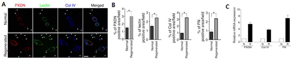 Hindlimb ischemia 모델에서 재생과정 중에 vessel density 및 PXDN, ColIV, FN 발현 변화 분석