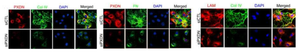 HUVEC에서 PXDN knockdown에 따른 ECM assembly의 변화 조사