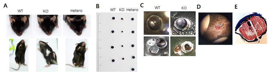 PXDN KO 마우스의 표현형(A), 안구 크기(B), 렌즈 혼탁(C) 비교 및 PXDN KO 마우스 안구의 hemorrahge(D) 관찰 및 조직의 Masson’s Trichrome 염색 (E)