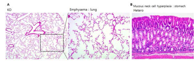 PXDN KO 마우스의 병리 표현형 분석 A: KO마우스의 폐, B: Hetero와 KO 마우스의 위 조직