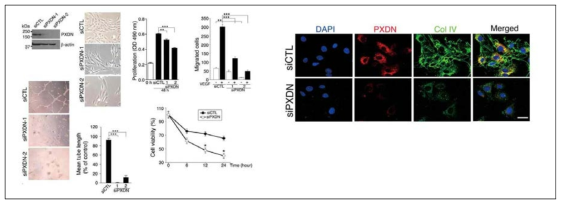 PXDN silencing에 따른 내피세포 활성 및 collagen type IV의 fibril 형성 변화