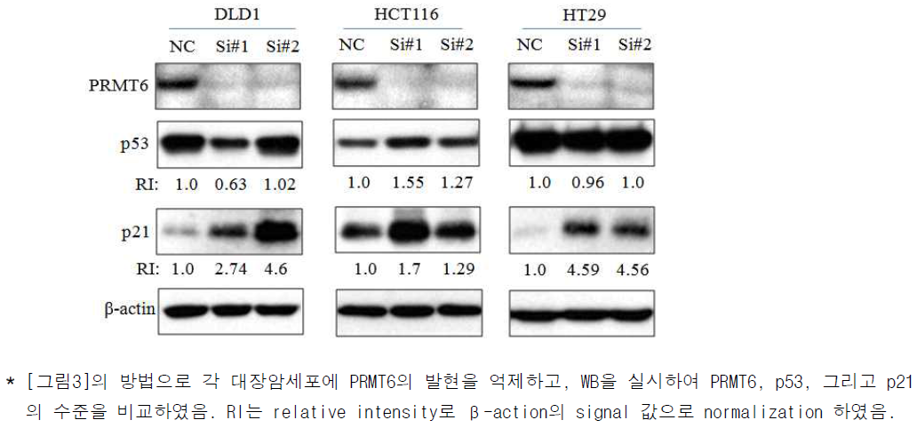 대장암세포의 PRMT6 발현억제에 의한 p21과 p53 발현변화 관찰