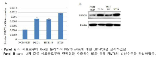 정상 및 대장암 cell line에서 PRMT6의 발현비교