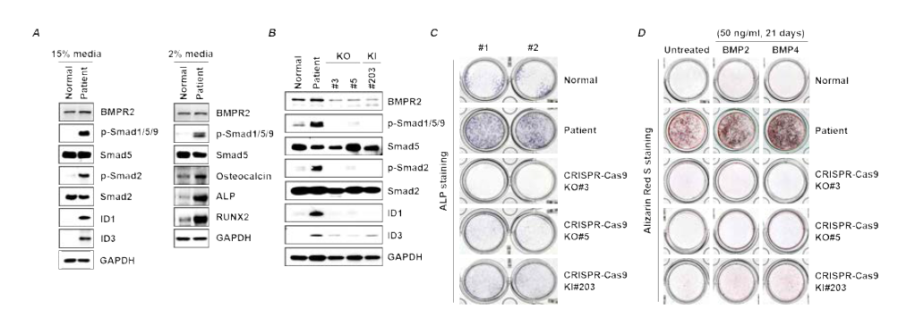 구축된 환자 유래 세포주에서 Smad와 골분화 단백질 발현 및 CRISPR-Cas9 유전자 가위로 교정된 환자 유래 세포주에서 골분화능 복구 정도 확인