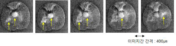 소동물 MRI를 이용한 척수내 공동의 이미징