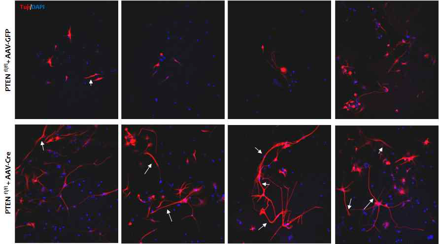 PTEN 유전자의 억제에 의한 신경줄기세포 축삭 성장의 촉진