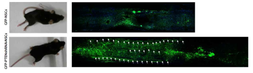 PTEN 억제 신경줄기세포의 이식 후 축삭성장