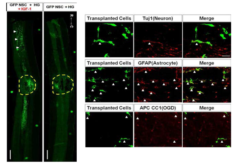 하이드로젤과 IGF-1 혼합체에 의한 이식 신경줄기세포 전이의 증가