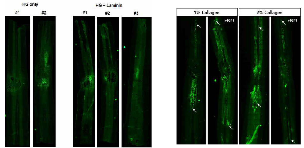 줄기세포 전달 효율 향상을 위한 다기능 하이드로젤 검증. 좌측: 하이드로젤 만을 이용한 이식. 중간: 하이드로젤과 Laminin 혼합이식. 우측: Collagen-하이드로젤 복합체를 이용한 이식