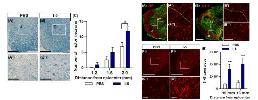 I-5 하이드로젤에 의한 운동신경원세포 재생 (좌측) 및 ECM으로의 축삭재생 (우측)