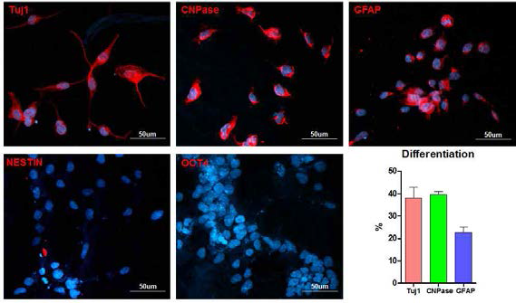 Human iPS의 성숙 신경세포 분화 확립