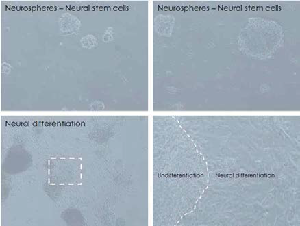 Human iPS의 신경계 세포로의 분화 좌상: Single cell로 분리된 hIPS를 neural stem cell media에서 배양하여 neurosphere를 형성한 모습. 우상: 좌측 그림의 확대사진. 좌하: Neurosphere를 VTN-n coated 배양용기에서 분화시키는 모습. 우하: 좌측의 점선 사각형내를 확대한 사진. 보다 성숙한 신경계 세포로 분화하고 있는 줄기세포들이 미분화 neurosphere에서 주변의 plate 바닥에 붙어서 전이하는 모습