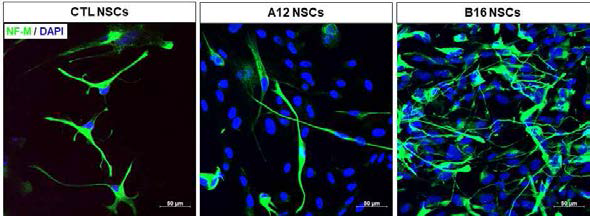 PTEN 결핍 세포주 유래 신경세포의 축삭 성장능 비교