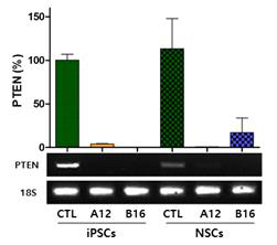 PTEN 결핍 iPS 세포 주 확립