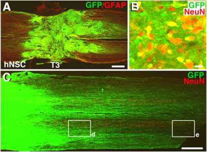 GFP 양성 줄기세포의 생존 및 축삭의 성장. 줄기세포의 생존과 축삭의 성장이 성공적인 치료효과를 나타낼 수 있음을 증명함