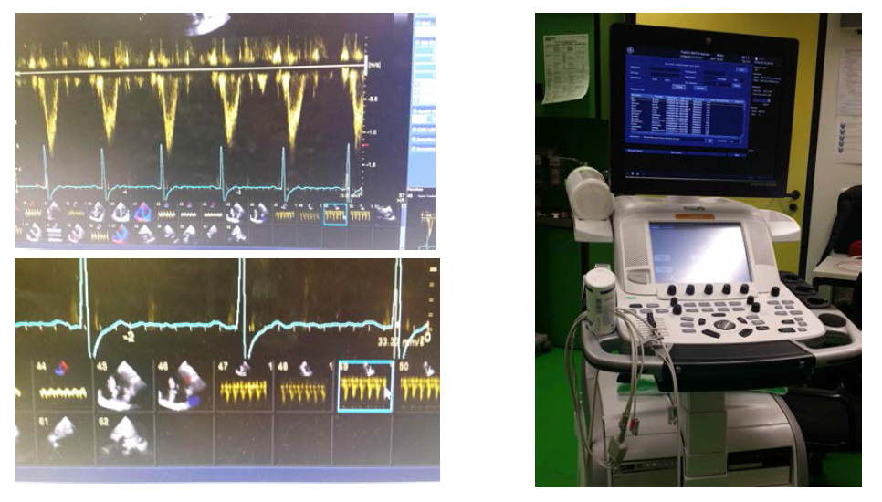 비교연구 수행을 위한 초음파도플러 화면과 비교연구장비