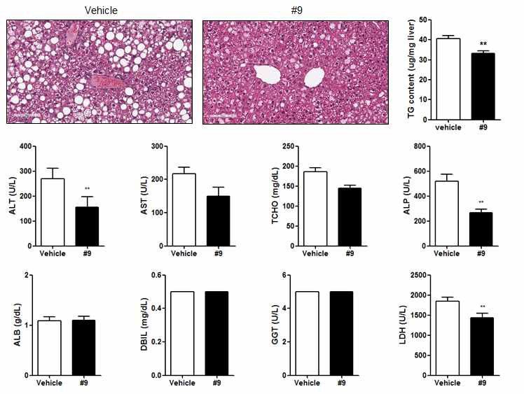 H&E staining of liver and blood chemistry level in vehicle or chemical treated ob/ob mice