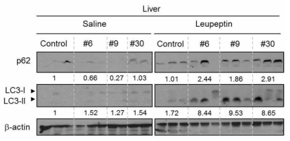 mouse에 최종 확인된 chemical 6, 9, 30을 투여한 후 β-actin, LC3-I, II을 immuno blot