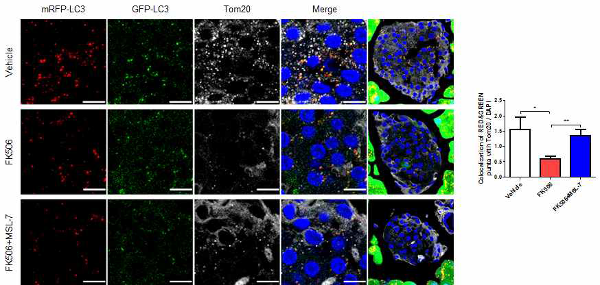FK506을 투여한 마우스에서 MSL-7에 의한 mitophagy의 회복. RFP puncta와 Tom20 colocalization으로 조사한 mitophagy가 FK506으로 감소하며 이는 MSL-7 투여로 회복됨