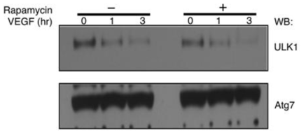 ULK1 단백질 분해에 mTOR 저해제를 처리하고 연관성 관찰