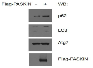 PASKIN의 과발현이 오토파지에 미치는 영향