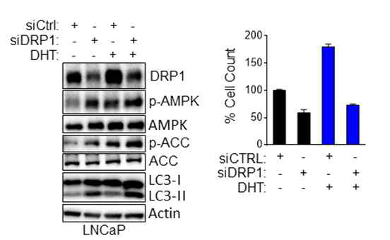 DRP1 저해에 의한 AMPK의 인산화와 Autophagy를 증가와 암세포 성장 억제