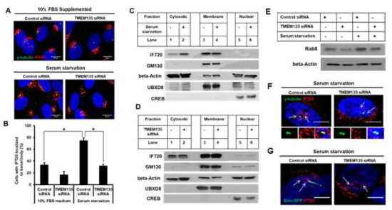 TMEM135 결여는 혈장결핍시 centrosomes/ basal body로 IFT20 위치화가 억제됨. 혈장 결핍시 정상세포는 세포질 IFT20 vesicle형성 유발하는 반면에 TMEM135결여세포는 차이가 없음