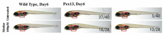 pex13 돌연변이 제브라피쉬에 metformin 처리시 지방간 표현형 회복 결과