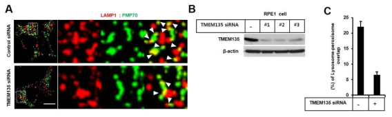 세포내 리소좀-퍼록시좀의 접촉인자 TMEM135 역할 확인