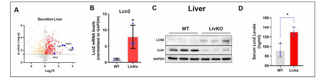 간에서의 Lcn2발현 확인