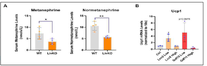 LivKo 혈청에서의 Catecholamine 농도