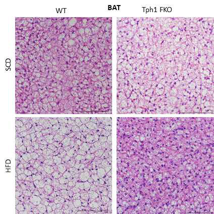 지방세포 특이적 Tph1 결손 마우스의 갈색 지방 H&E 염색사진