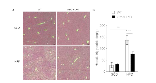 고지방식이 섭취 Htr2a Liver KO 마우스의 간지방증 개선