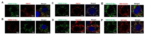 RPE1 (A&B)과 Huh7(C&D)세포에서 TMEM135-Myc표지로 퍼록시좀 세포소기관 단백 위치확인