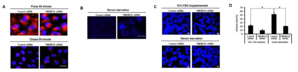 TMEM135 결여시 Alexa Flor 568 transferrin으로 표지된 endosome의 ERC감소, 리소조옴에 filipin 염색 검출결과 콜레스테롤 축적 및 Smoothened-GFP 검출 결과 일차섬모의 수적 감소