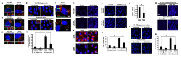 TMEM135 결여가 Rab8운송의 장애요인으로 basal body로 운송 장애 결과 섬모생성이 억제됨. ABCD1결여는 세포내 콜레스테롤 수송 장애와 일차섬모 형성 감소 확인