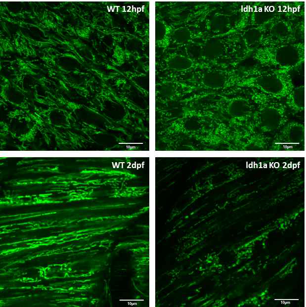 제브라피쉬 발생배아에서 ldh1a KO 제브라피쉬 발생배아의 미토콘드리아 형태 변화