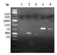 전기영동법을 통한 Universal HA와 Ferritin 유전자 확인