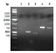 전기영동법을 통한 Universal HA와 Ferritin 유전자 확인