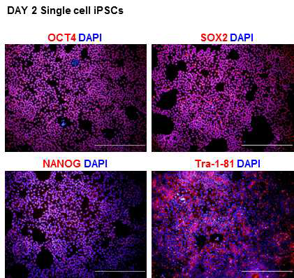 CFC 환자 유래 인간역분화줄기세포의 단일세포 단위 배양시 줄기세포 특이적 단백질 발현