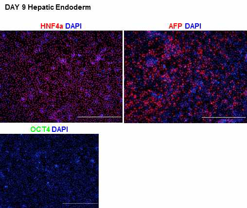 간 내배엽 전구세포에서의 전구세포 특이적 단백질과 줄기세포 특이적 단백질 발현 확인