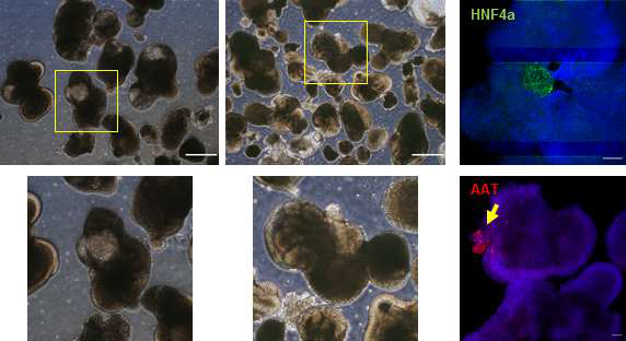 3D 간세포에서 일부의 세포만 간세포 특이적 단백질을 발현하는 현상