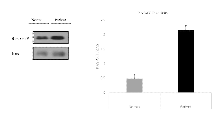 환자의 섬유아세포에서 RAS-GTP가 항진되어 있음을 발견하여, ARID2와 Ras-MAPK pathway의 연관성을 검증