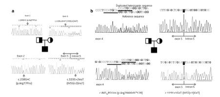 Focal facial dermal dysplasia 4형의 두명의 환자에서 CYP26C1의 돌연변이 (Journal of Human Genetics (2018) 63:257–261)