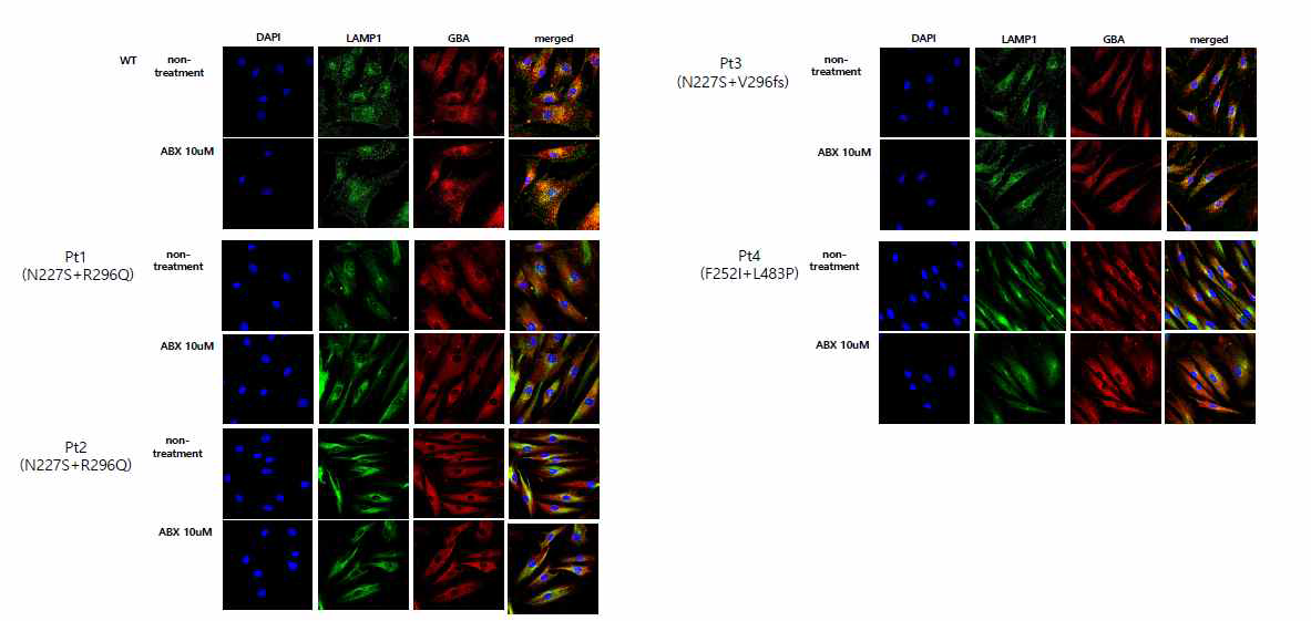 환자의 체세포에서 암브록솔 처리 후 GBA의 라이소좀으로의 분포 분석